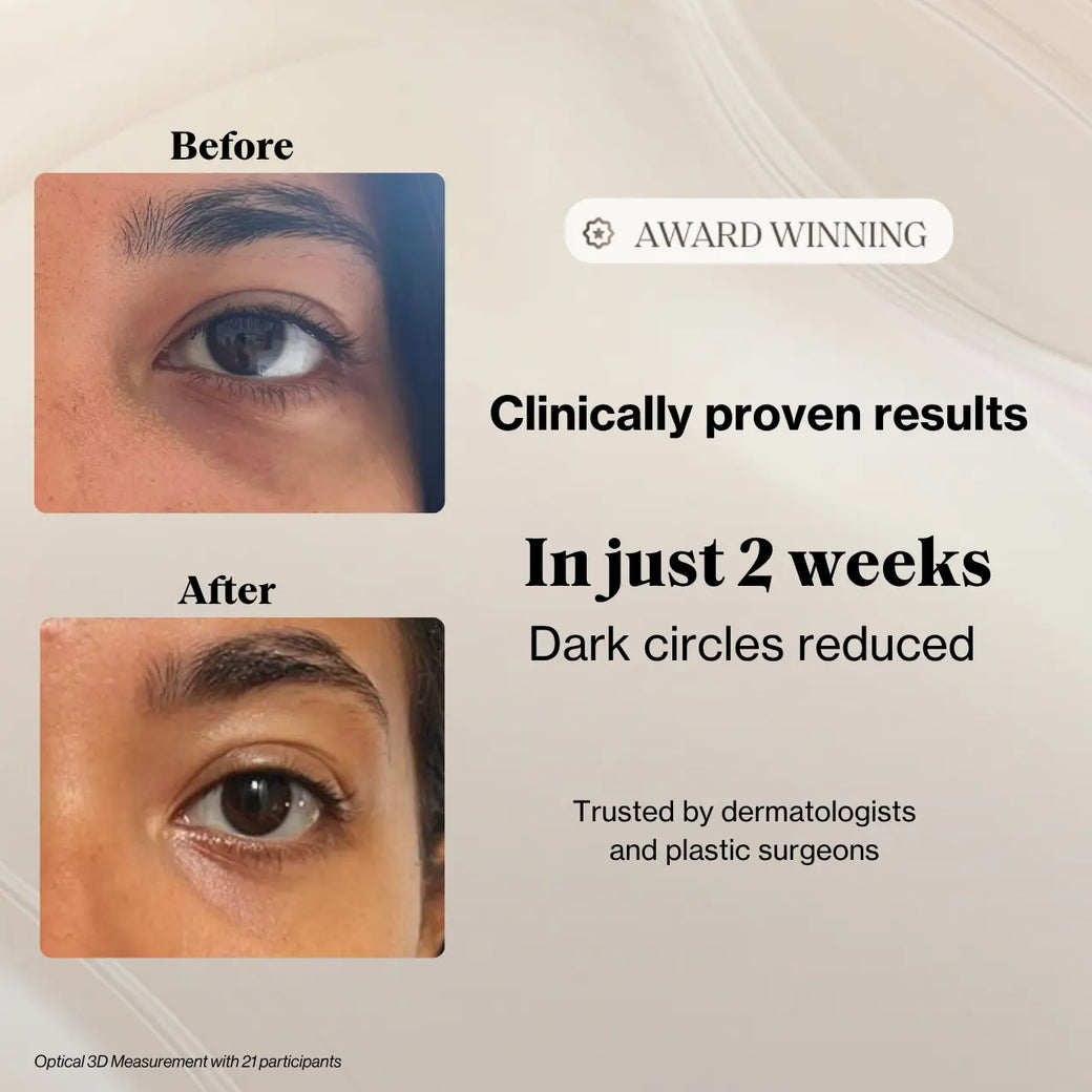Le Kit Eye Reset 15 min