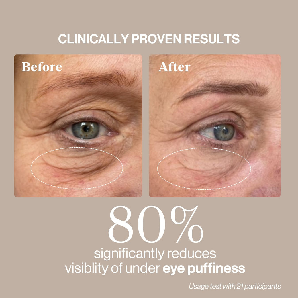 The 3-Month De-Puffing Eye Ritual