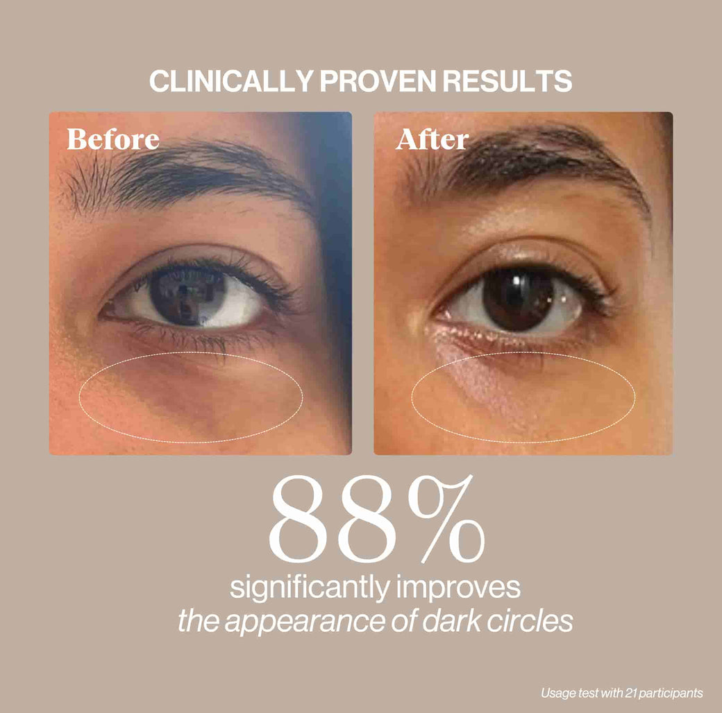 CRÈME CONTOUR DES YEUX & PATCHS YEUX