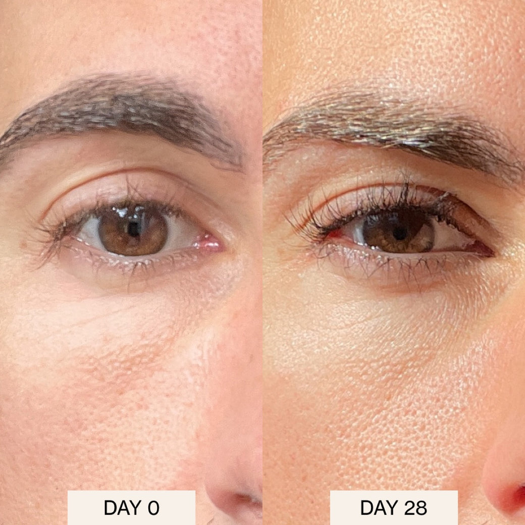 IRAYE before and after