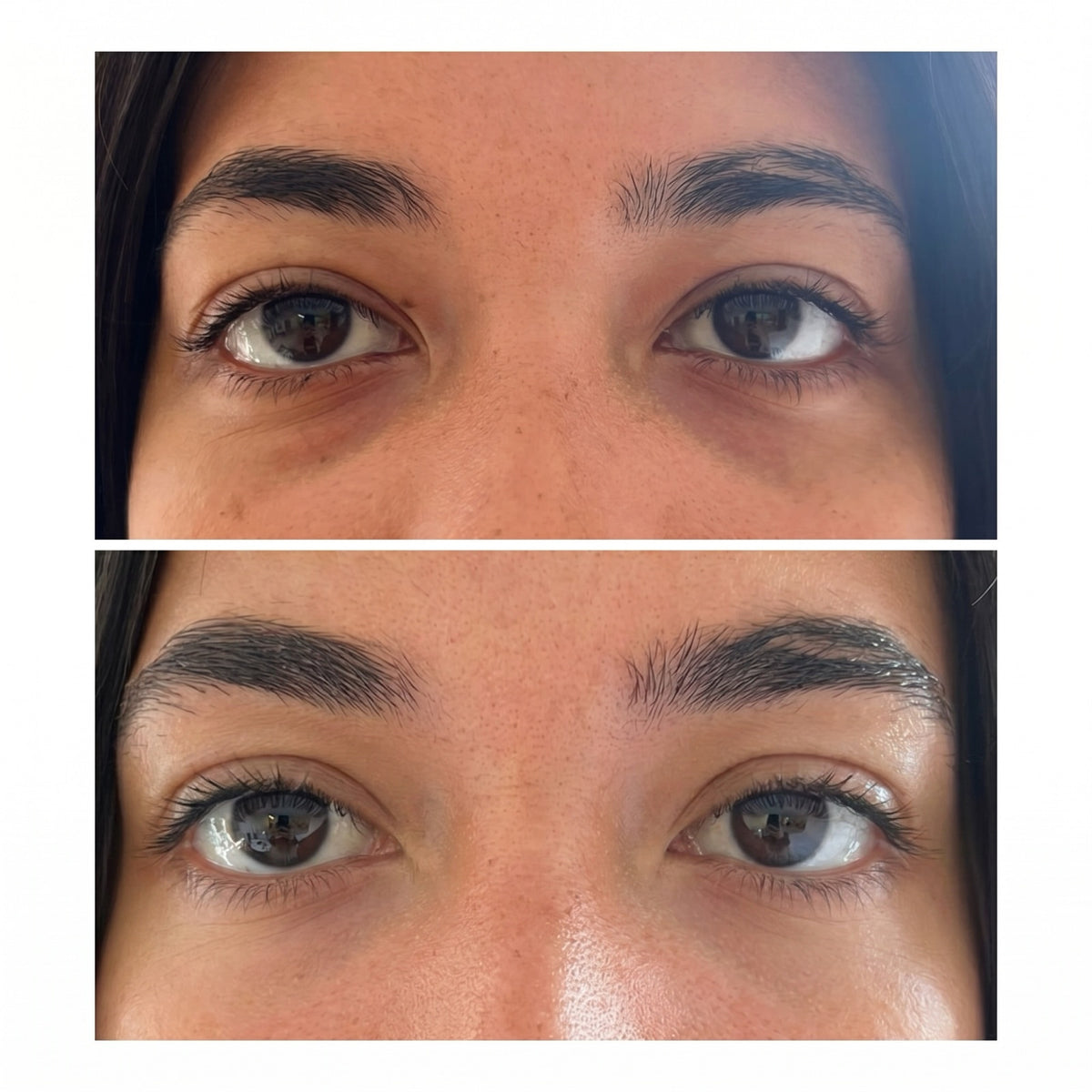 Eye Revive before and after